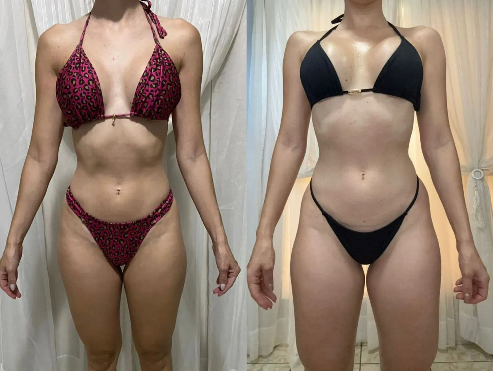 Antes e Depois 3